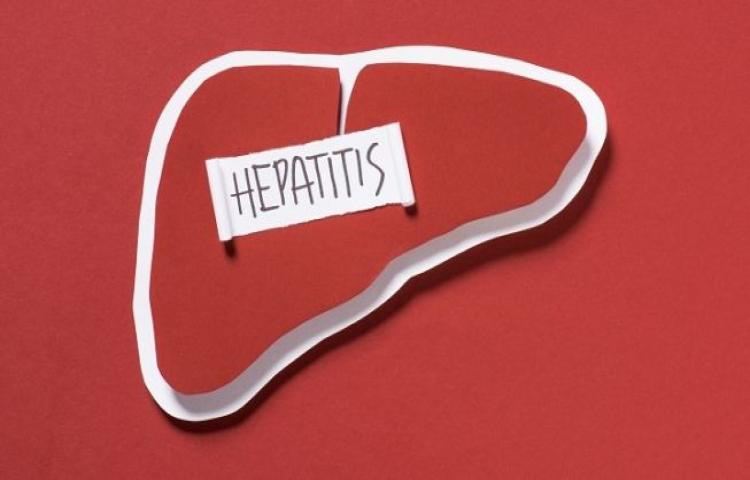 Soal Hepatitis Akut, Dinkes Bali Harap Orangtua Kenali Gejalanya